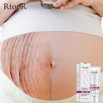 crema anti-imbatranire in timpul sarcinii)